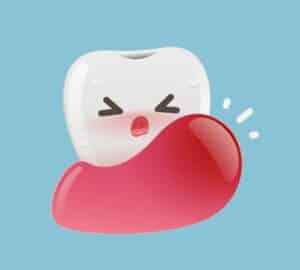 Dental abscess