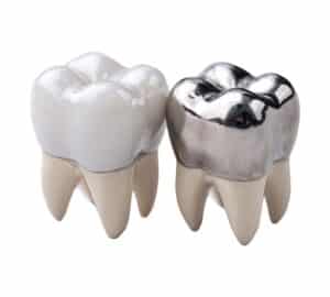 Fillings