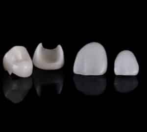 what is the difference between crowns and veneers