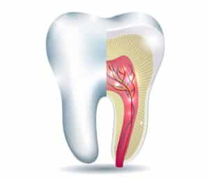 root canal treatment involve2