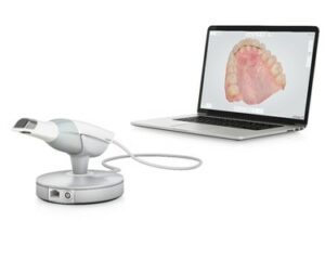 3Shape Dental Scanner