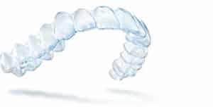 Invisalign Aligners