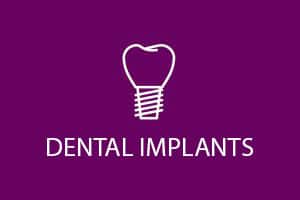 dental implants