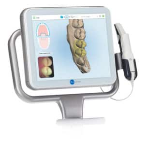 iTero Intraoral Scanner