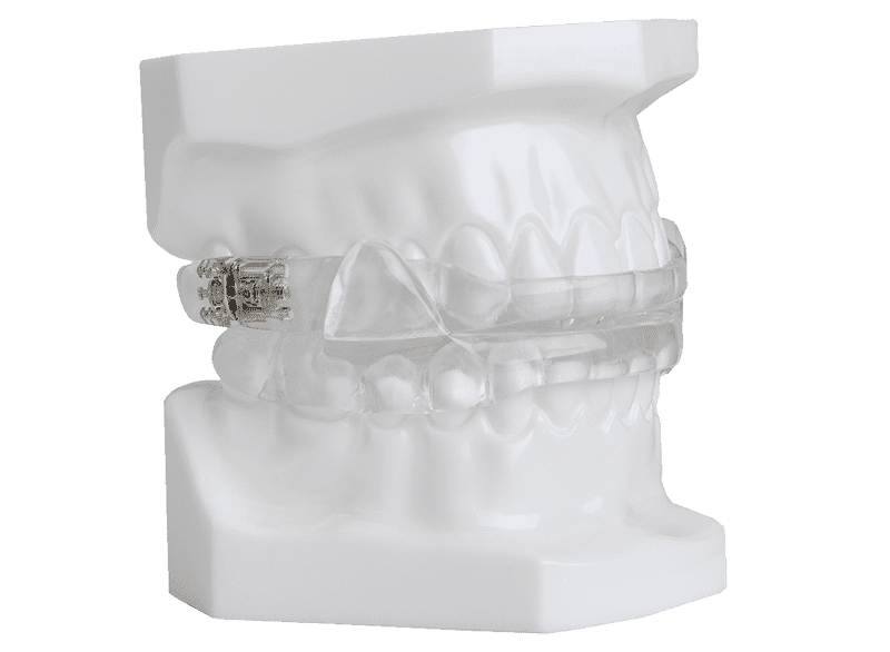 Mandibular Advancement Splint 2