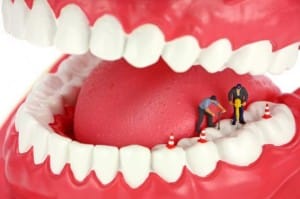 bridges implants dentures