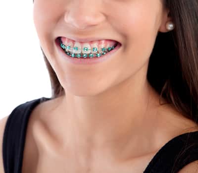 common complaints conventional braces