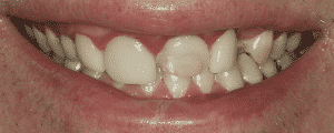 cosmetic dentistry options for improving the look for my smile