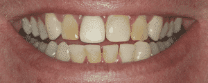 cosmetic dentistry options for improving the look for my smile