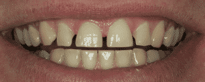 cosmetic dentistry options for improving the look for my smile