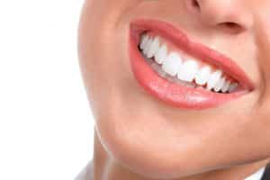 difference crowns and veneers