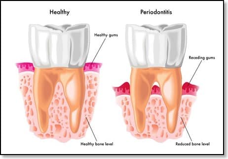 health problems linked to poor oral hygiene