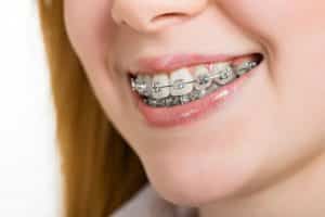 how long take orthodontic treatment