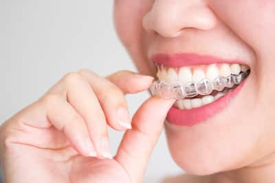 hygiene benefits invisalign