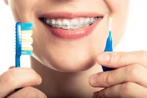 keep teeth clean wearing braces