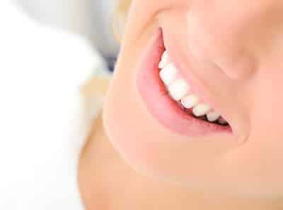 know teeth whitening