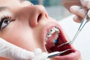 orthodontic treatment dentist vs specialist orthodontist