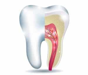 root canal treatment involve