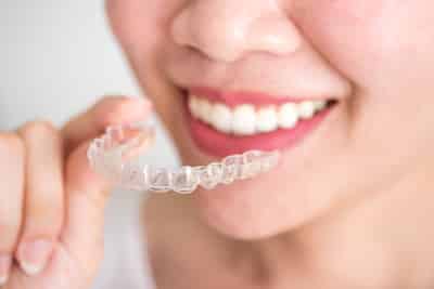 speeding up invisalign treatment with acceledent
