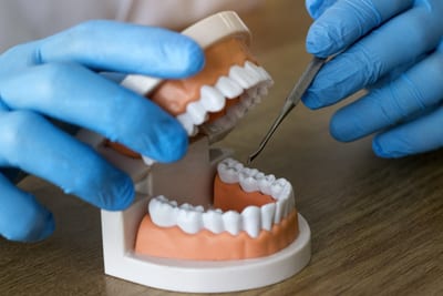 types dental crown available