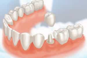 what is restorative dentistry