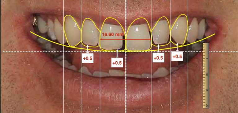 whats new in cosmetic dentistry