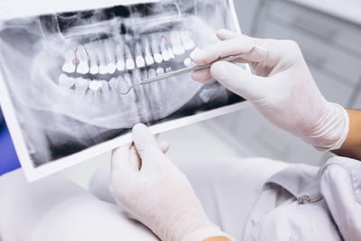 safe dental x rays become unsafe