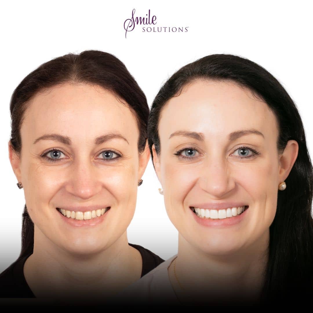 Dr Avi Aggarwal 1 Smile 1