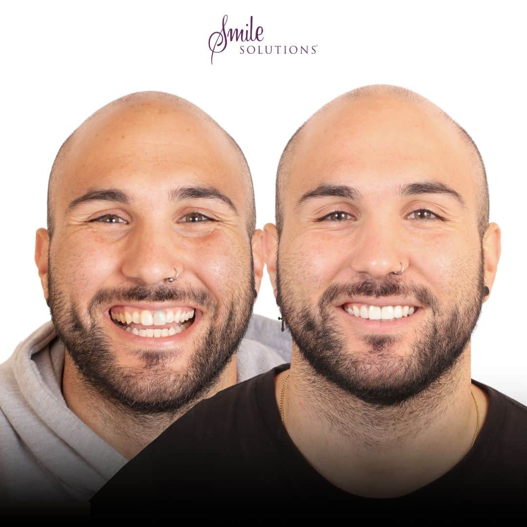 Dr Avi Aggarwal 2 Smile 2