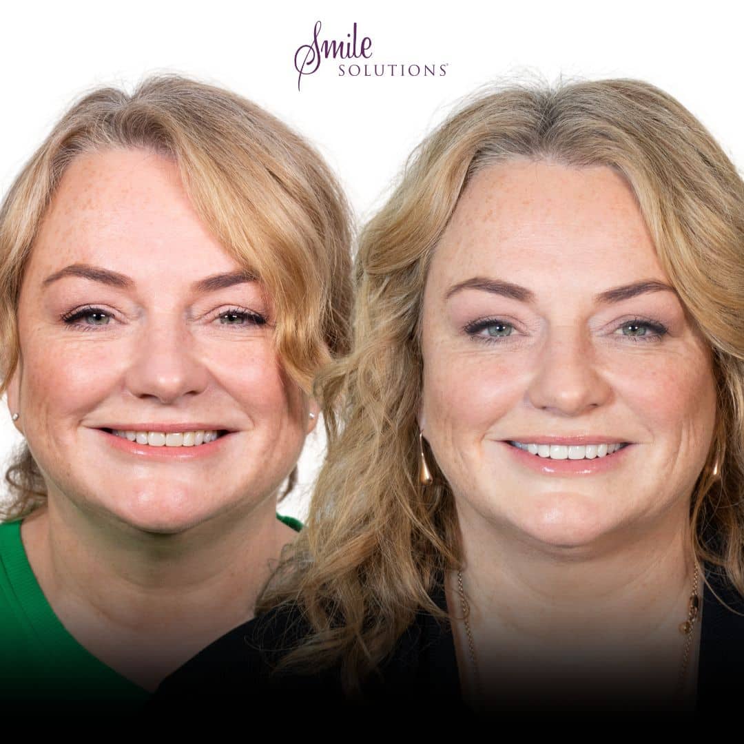 Dr Amina Barucija 22 AB17