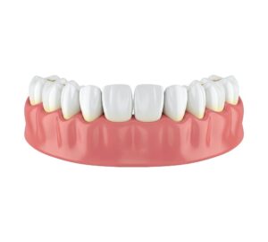 Gum Health Smile Solutions