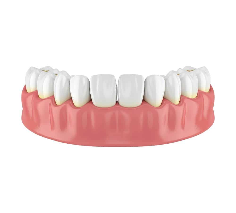Gum Health Smile Solutions