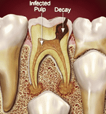 Why Baby Teeth are Important 3 33