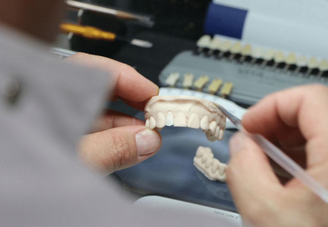 The case for SameDay Porcelain Veneers™ versus Temporary Veneers worn