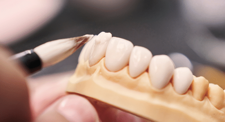 Dental model with brush application