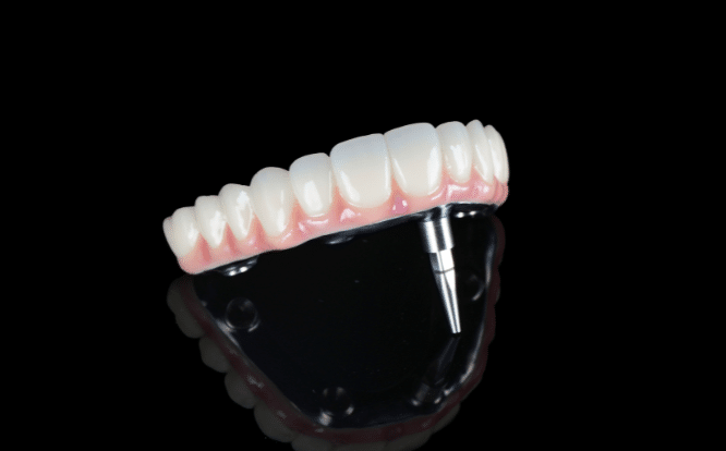 All-On-4® Dental Implants 2 All-On-4 Melbourne Smile Solutions