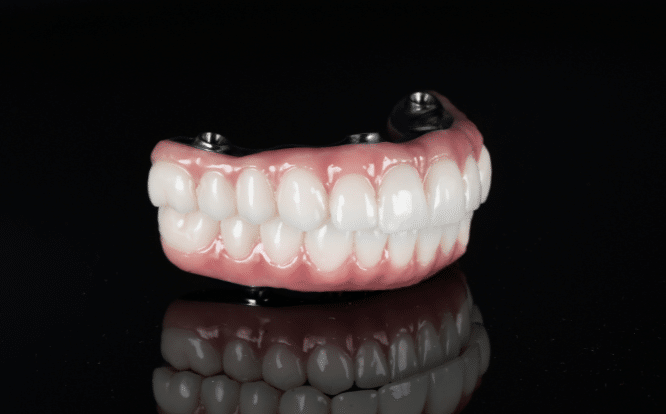 All-On-4® Dental Implants 7 All-on-4 Melbourne Smile Solutions