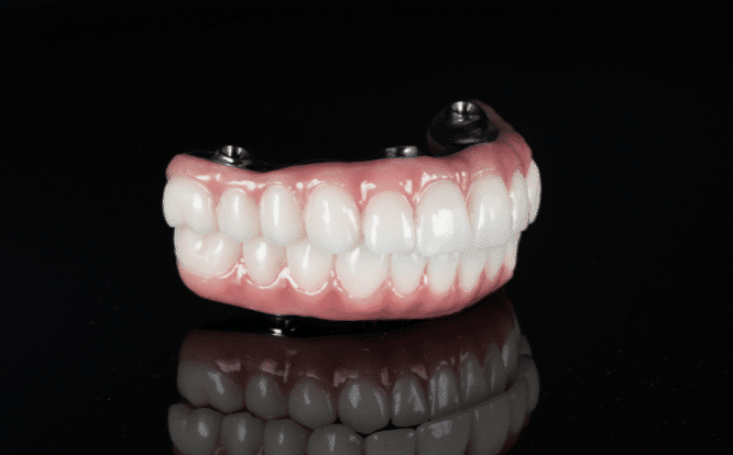 Our Difference All-on-4 7 all on 4 handcrafted ceramic