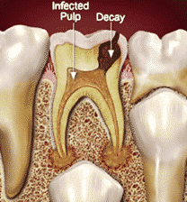 Why Baby Teeth are Important 2 why baby teeth are important 2
