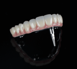 Dental prosthesis with natural appearance