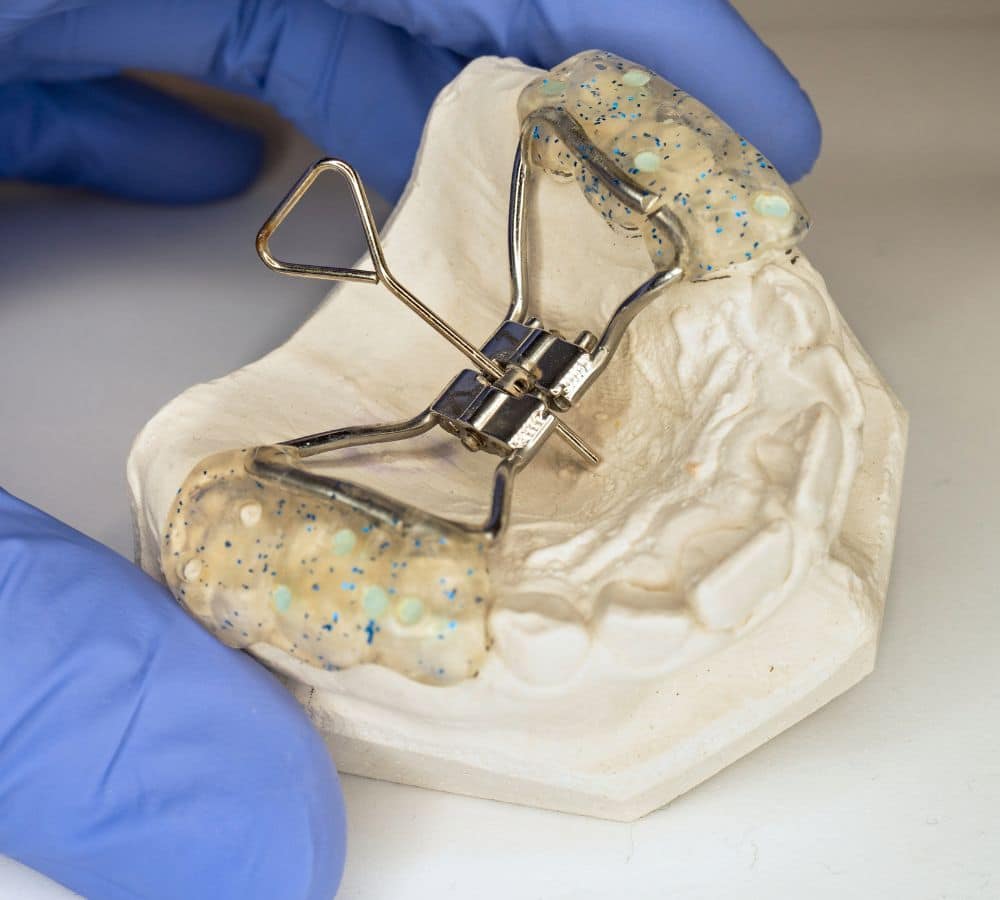Palatal and arch