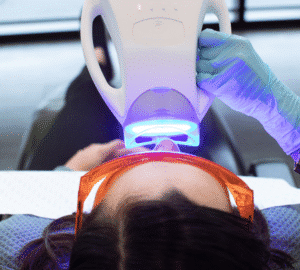 Professional In-Chair Teeth Whitening Smile Solutions Melbourne