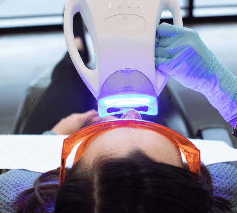 Professional In-Chair Teeth Whitening Smile Solutions Melbourne