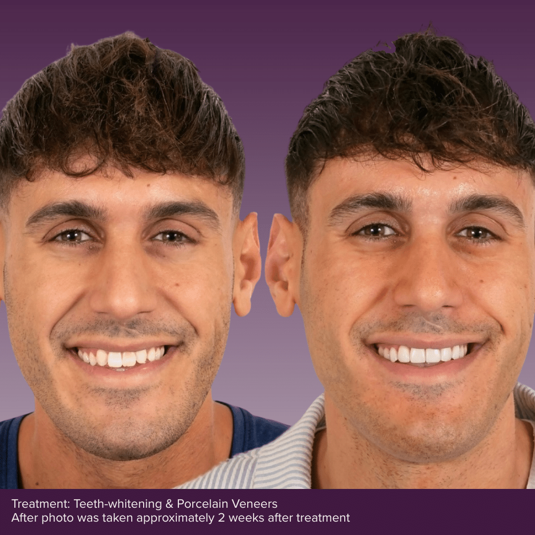 Smile Consult Page BAs 1