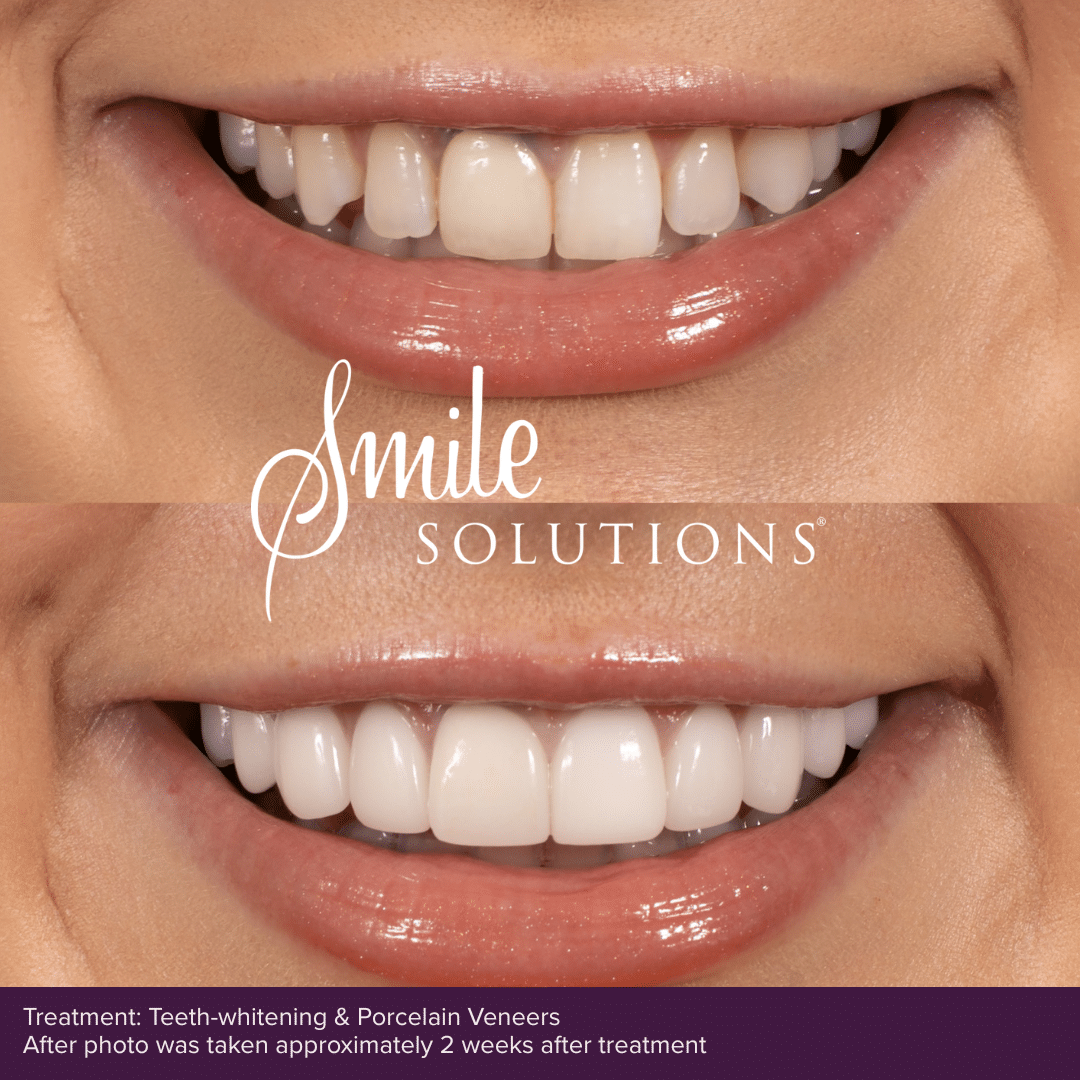 Smile Consult Page BAs 3