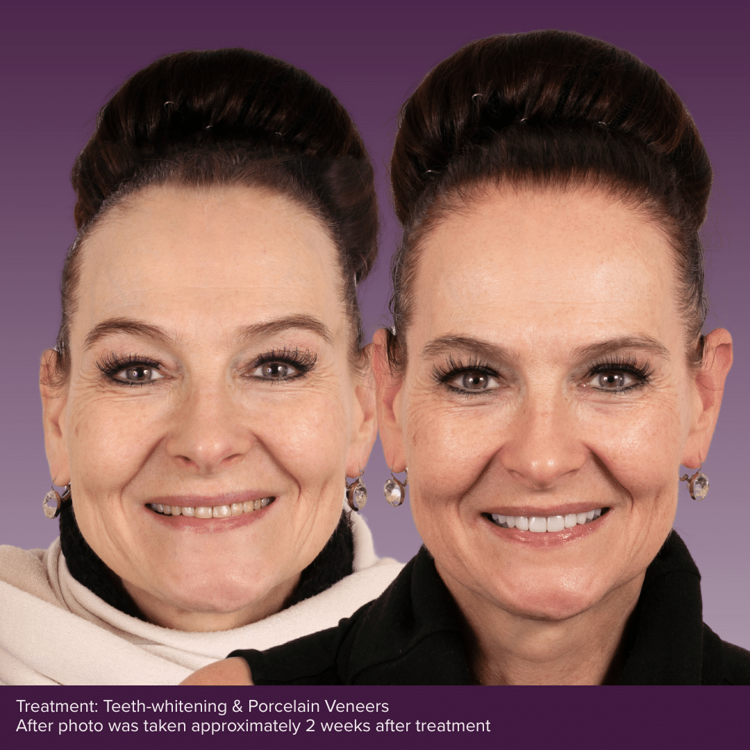 Smile Consult Page BAs