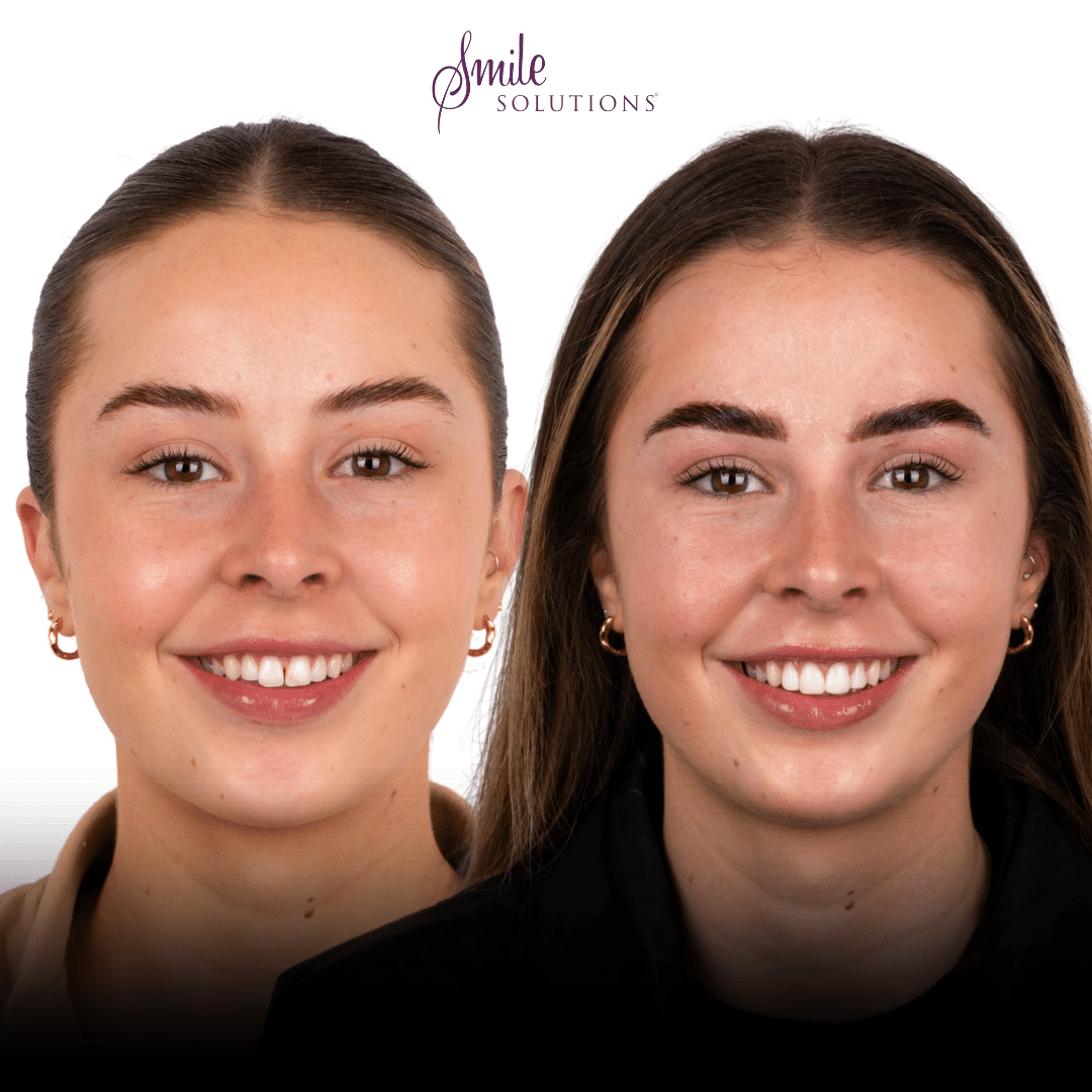 Dr Amina Barucija 9 Smile Solutions