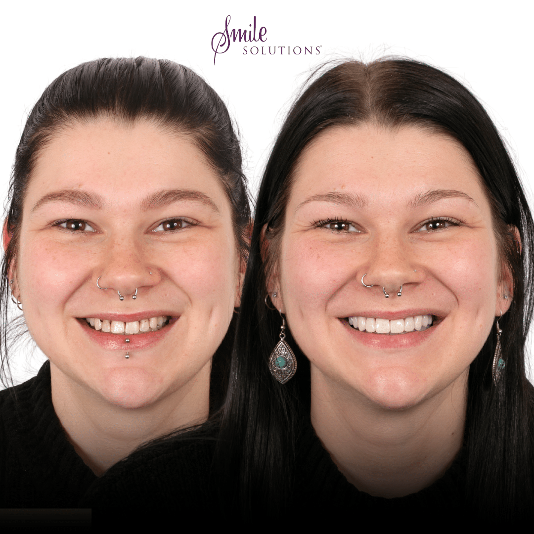 Dr Amina Barucija 8 Smile Solutions