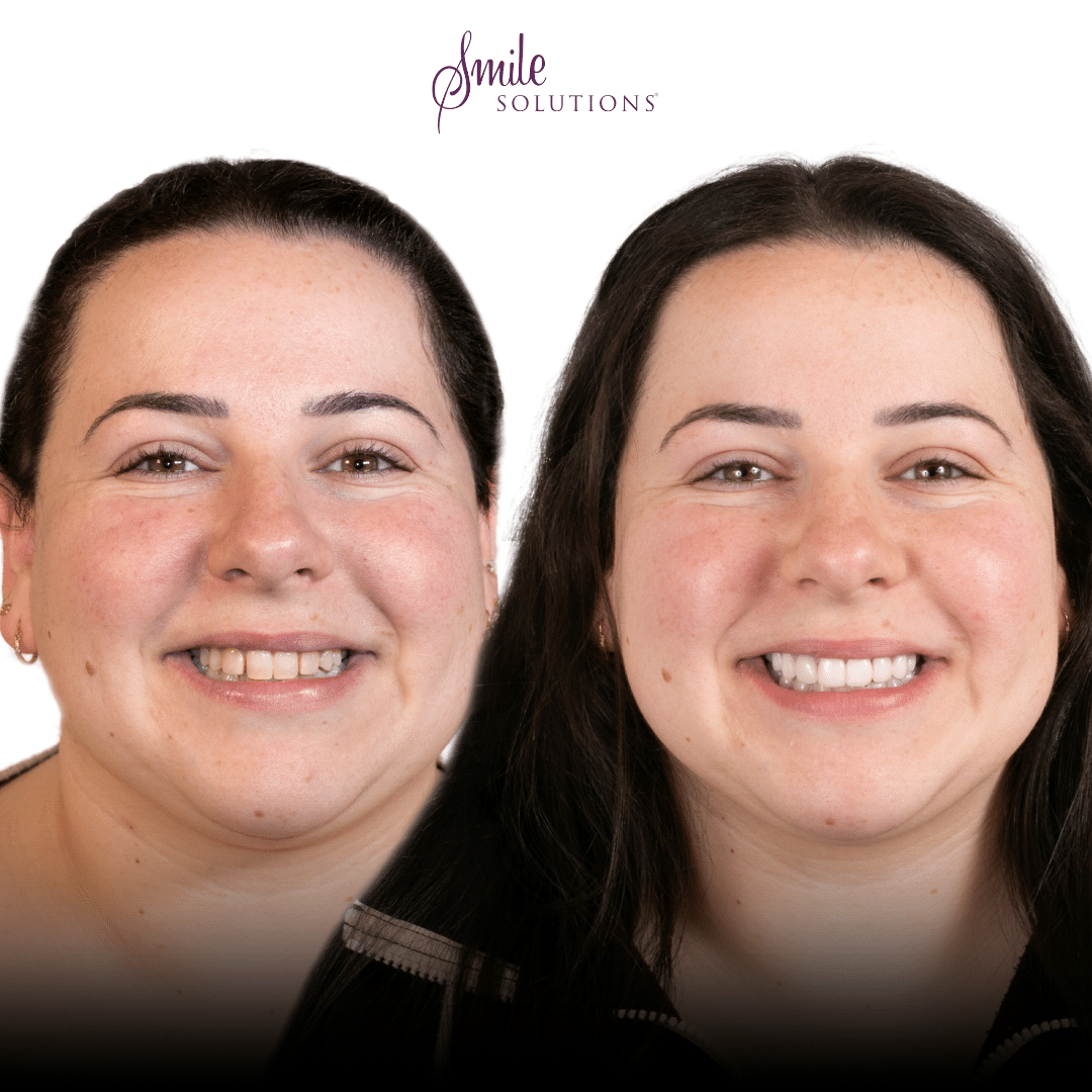 Dr Amina Barucija 5 Smile Solutions