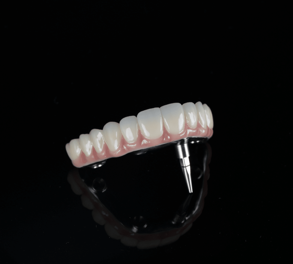 All on 4 at Smile Solutions